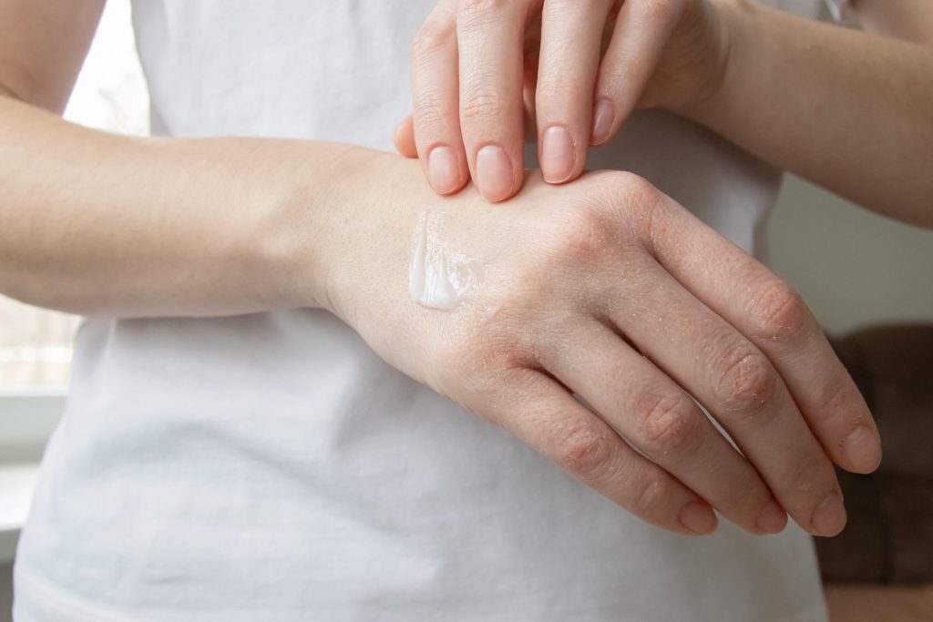 Woman applying moisturizing cream to dry, irritated skin on her arm.
