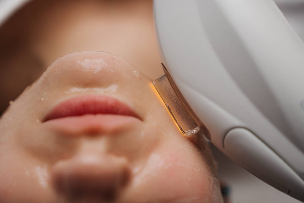 Client receiving an IPL photorejuvenation photofacial treatment at a skin care clinic.