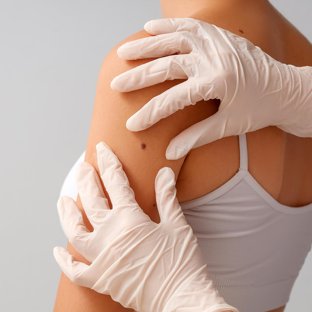 Dermatologist examining a patient's skin