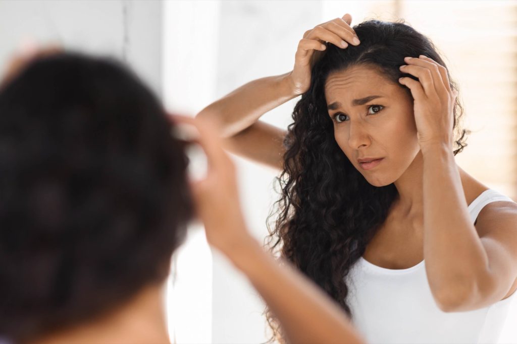 Woman checking flaking, dandruff-covered scalp caused by seborrheic dermatitis.